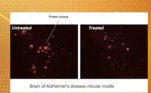 Algumas fotos da pesquisa mostram a redução de proteínas tóxicas após três meses de tratamento 