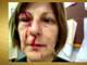 A
foto com sangue no rosto marcou a história de Márcia, professora de português,
agredida por um aluno de 15 anos na sala de aula de uma escola pública em Santa
Catarina