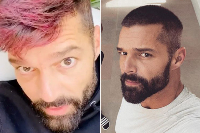 Rick Martin foi um dos que aderiram aos cabelos cor de rosa 