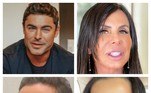 A harmonização facial virou modinha entre os famosos. Diante da pressão estética, eles têm recorrido cada vez mais ao procedimento. O problema é que, em alguns casos, o resultado não sai como o esperado. Fato é que a internet não perdoa e sempre emite opiniões sobre as mudanças de aparência das celebridades. Veja sete artistas que já foram criticados após mudar os traços do rosto por meio desse processo