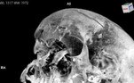 Segundo o exame, o monarca provavelmente foi brutalmente assassinado no campo de batalha e ficou com grandes fraturas no crânio