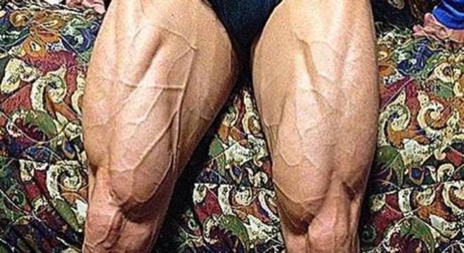 As pernas de Felipe Franco, marido de Juju Salimeni, sempre chama a atenção nas redes sociais 