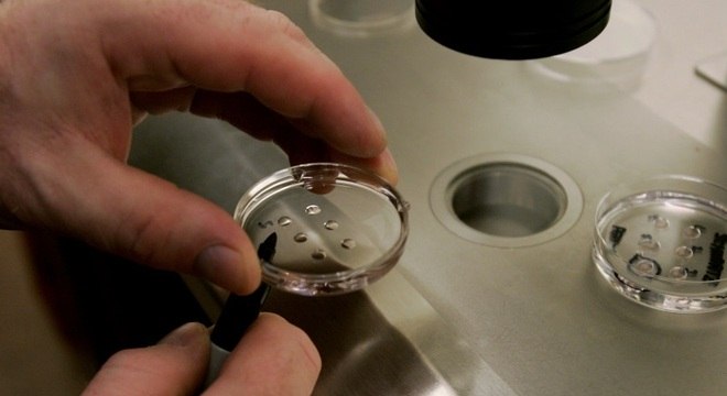 Alguns especialistas acreditam que testes genéticos podem agredir os embriões