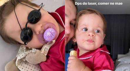 Filha de Virginia e Zé Felipe faz laser no bumbum aos 9 meses de vida 