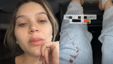 Filha do cantor Leandro sofre acidente em casa e mostra roupa cheia de sangue: 'Esmagou meu dedo' 