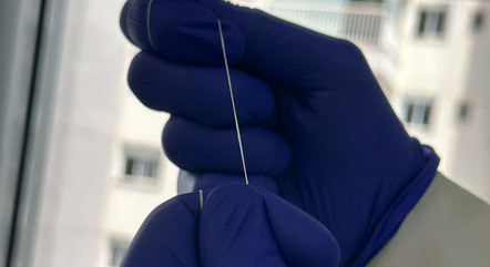 Criado em 1815, o fio dental moderno passou por transformações para melhorar a higiene bucal
