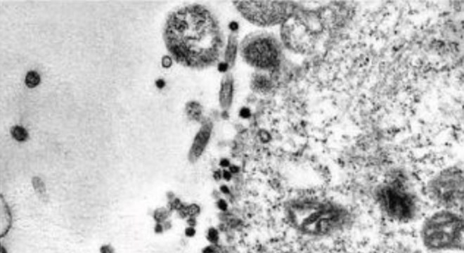 Imagem mostra momento em que célula é infectada pela covid-19 