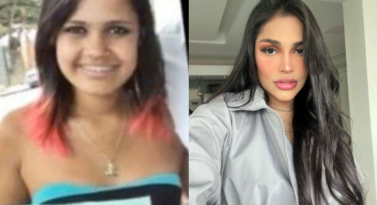 Além de harmonização facial, lipo LAD e rinoplastia, a influenciadora digital Flay colocou 20 lentes de contato dentais. Segundo informações, o procedimento custou R$ 40 mil. Os internautas não deixaram as mudanças visuais da influencer passarem em branco. 'A Flay já teve quatro rostos em uma só vida', afirmou um. 'A Flay não brinca quando o assunto é mudar o visual', disse outro