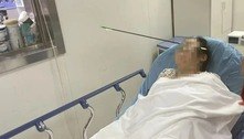 Mulher é atingida na cabeça por flecha de 70 cm na China