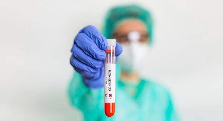 Monkeypox: ES hat 148 bestätigte Fälle;  Meist unter Männern – Städte