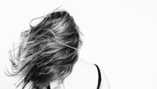Dermatologista especialista em cabelos explica como tratar a calvície feminina