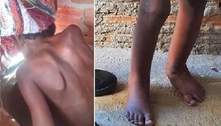 Justiça aceita denúncia de tortura contra família de menino encontrado dentro de tonel