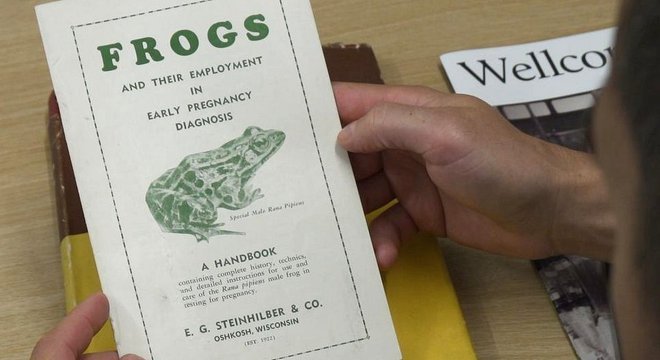  Exames de gravidez modernos só se popularizaram nos anos 1990 
