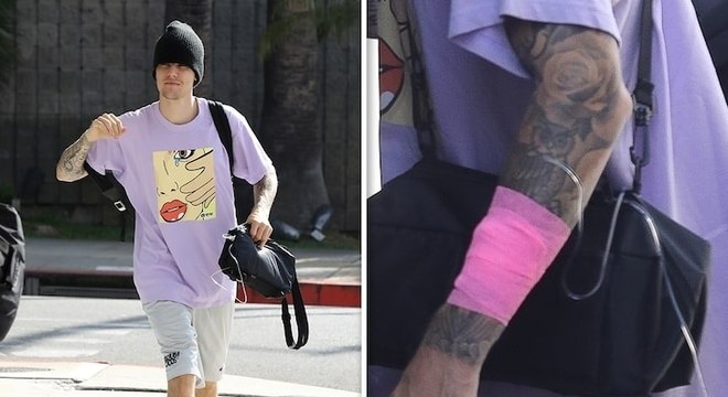 Justin Bieber foi diagnosticado com a doença de Lyme, diz site