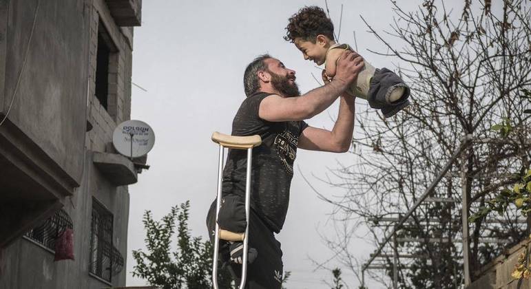 Fotógrafo espera que foto ajude menino a conseguir próteses para braços e pernas