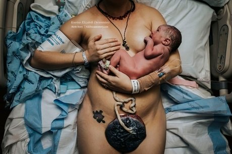 Fotos incríveis que parto que ganharam prêmio internacional