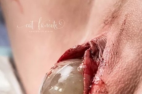 Fotos incríveis que parto que ganharam prêmio internacional