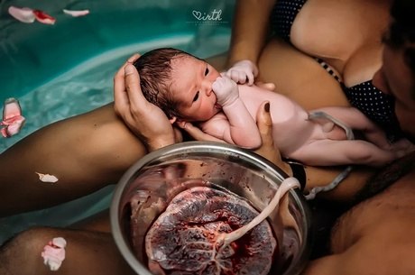 Fotos incríveis que parto que ganharam prêmio internacional