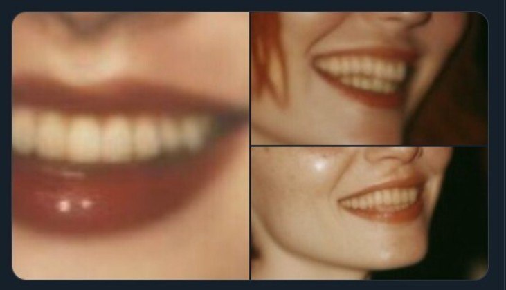 Como ressaltou uma resposta, todos os dentes são perfeitos. O resultado é um efeito chamado de 