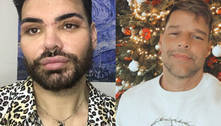 Ator faz mais de 30 cirurgias para se parecer com Ricky Martin; veja