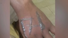 Funcionários acusam patrões de tatuarem '171' no corpo deles usando ferro quente