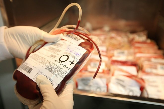 Qual a diferenÃ§a entre doaÃ§Ã£o de sangue e plasma? O plasma Ã© um componente do sangue que pode ser doado conforme a necessidade do paciente. PorÃ©m, diferentemente de outros paÃ­ses, no Brasil nÃ£o hÃ¡ comercializaÃ§Ã£o de plasma. Odila explica que, em paÃ­ses como os EUA, a pessoa pode receber uma recompensa financeira pela doaÃ§Ã£o de plasma que Ã© direcionada para a indÃºstria farmacÃªutica que fabrica produtos hemoderivados*EstagiÃ¡ria do R7 sob supervisÃ£o de Deborah Giannini