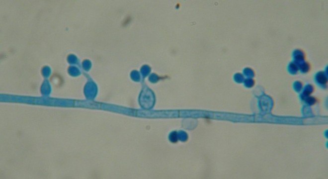 O fungo Lomentospora prolifican causou a primeira morte na AmÃ©rica do Sul