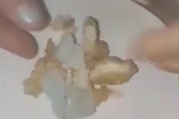 Um porta-voz do McDonald's lamentou o ocorrido: 'Pedimos desculpas, oferecemos reembolso total e gostar�amos que a cliente devolvesse o produto para que possamos investigar o assunto e isolar os itens afetados', declarouJ� uma 'mancha negra' no c�u da boca de uma beb� levou outra m�e do terror �s risadas. Entenda a seguir!