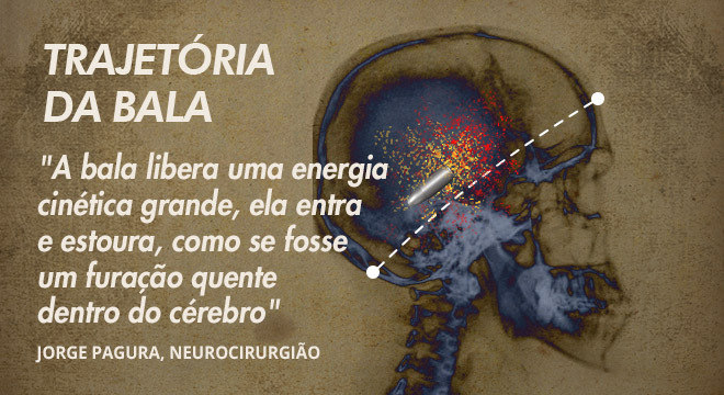 “Não acreditávamos nem mesmo em sobrevida”, acrescentou o especialista