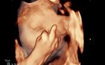 Mas uma das fotos foi completamente inesperada: o bebê de 30 semanas aparece estendendo o dedo do meio