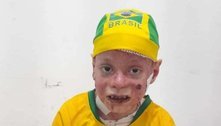 Neymar realiza sonho de menino com doença rara antes do jogo do Brasil; assista