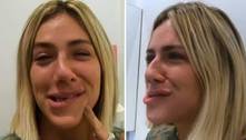 Giovanna Ewbank relembra boca anestesiada após ida ao dentista