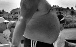 gordura-corpo-gordo