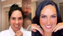 Graciele Lacerda mostra antes e depois de se arrumar para show de Zezé: 'Transformação de respeito'