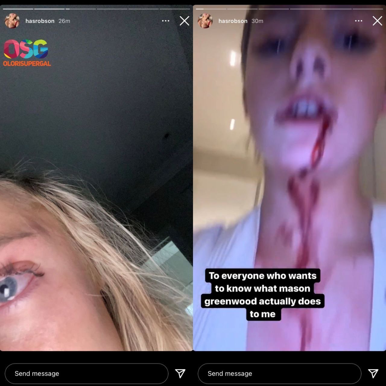 Ex-namorada do jogador expôs agressões nas redes sociais
