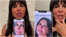 Gretchen mostra 'antes e depois' de harmonização facial após críticas de médica e desafia: 'Faça melhor'