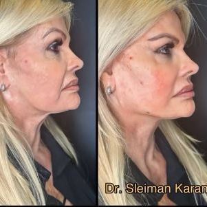 Ex-modelo vai se encontrar com o médico a cada 20 dias