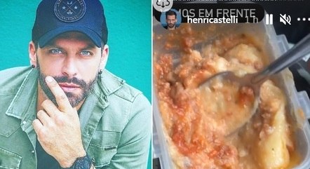 Ator está com dieta pastosa por causa da fratura