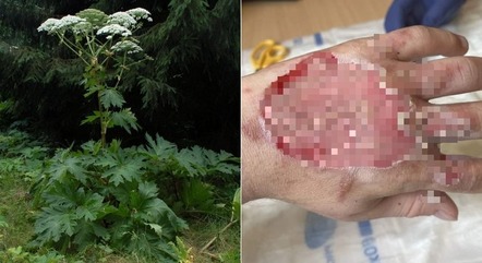 Ambrósia é conhecida como uma das plantas mais venenosas do Reino Unido