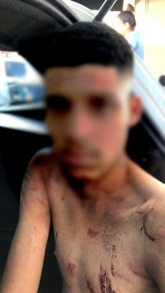 Enzio Miguel Alves da Costa, de 20 anos, foi morto a tiros por ter conversado com a namorada do atirador, em um bar de Osasco, na Grande São Paulo, no início deste mês. O suspeito tentou fugir, mas foi contido por populares até a chegada da polícia