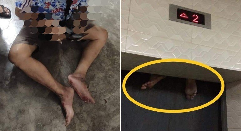 Homem quase perdeu as pernas em elevador e ainda entalou entre dois andares