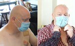 O homem acima afirma ter levado duas mordidas no peito em um ônibus, após tentar corrigir um dos passageiros sobre como usar a máscara contra o novo coronavírus