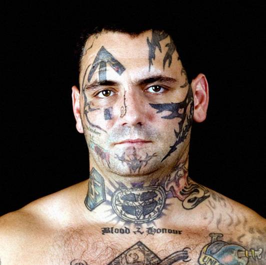 Bryon decidiu remover as tatuagens de Ã³dio no corpo