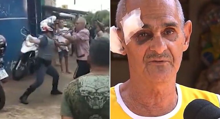 Luiz Custódio da Silva ficou com olho roxo e ferimentos na testa e na orelha
