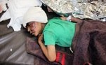 Criança ferida em bombardeio no Iêmen, que atingiu onibus escolar em 9.8.2018