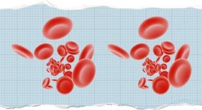 Alterações no sangue de pacientes com covid-19 também têm intrigado médicos