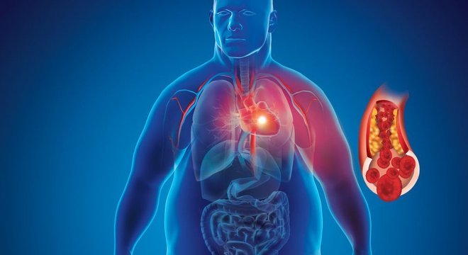 A obesidade é uma das grandes ameaças à saúde em nossos tempos