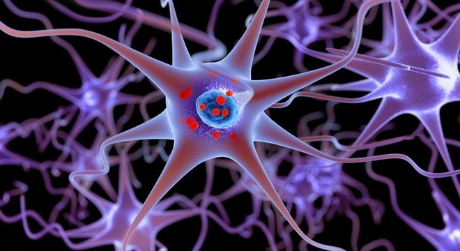  Ilustração mostra neurônios e, dentro deles, em vermelho, depósitos de alfa-sinucleína acumulados; falhas no funcionamento das células em seu início foram detectadas, o que ajuda a explicar o Parkinson 