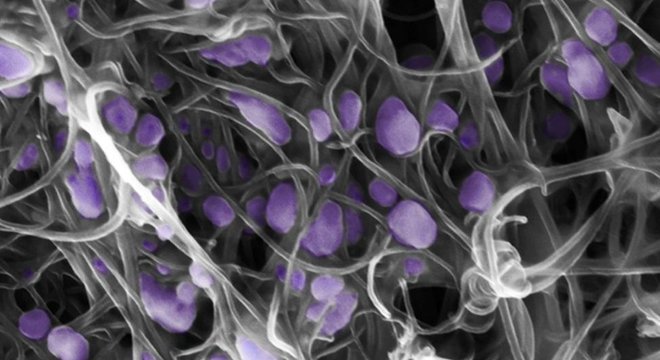  Terrones e sua equipe trabalham com vírus como o H5N2, captado nesta imagem com nanotubos