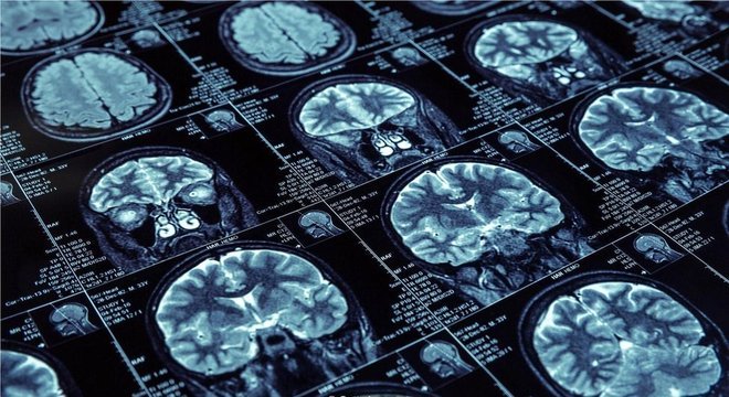 Durante o sono de ondas lentas, o hipocampo e o neocórtex se comunicam para codificar informações na memória de longo prazo 